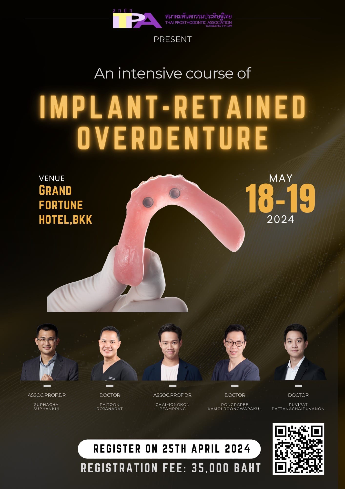 Implant-retained overdenture